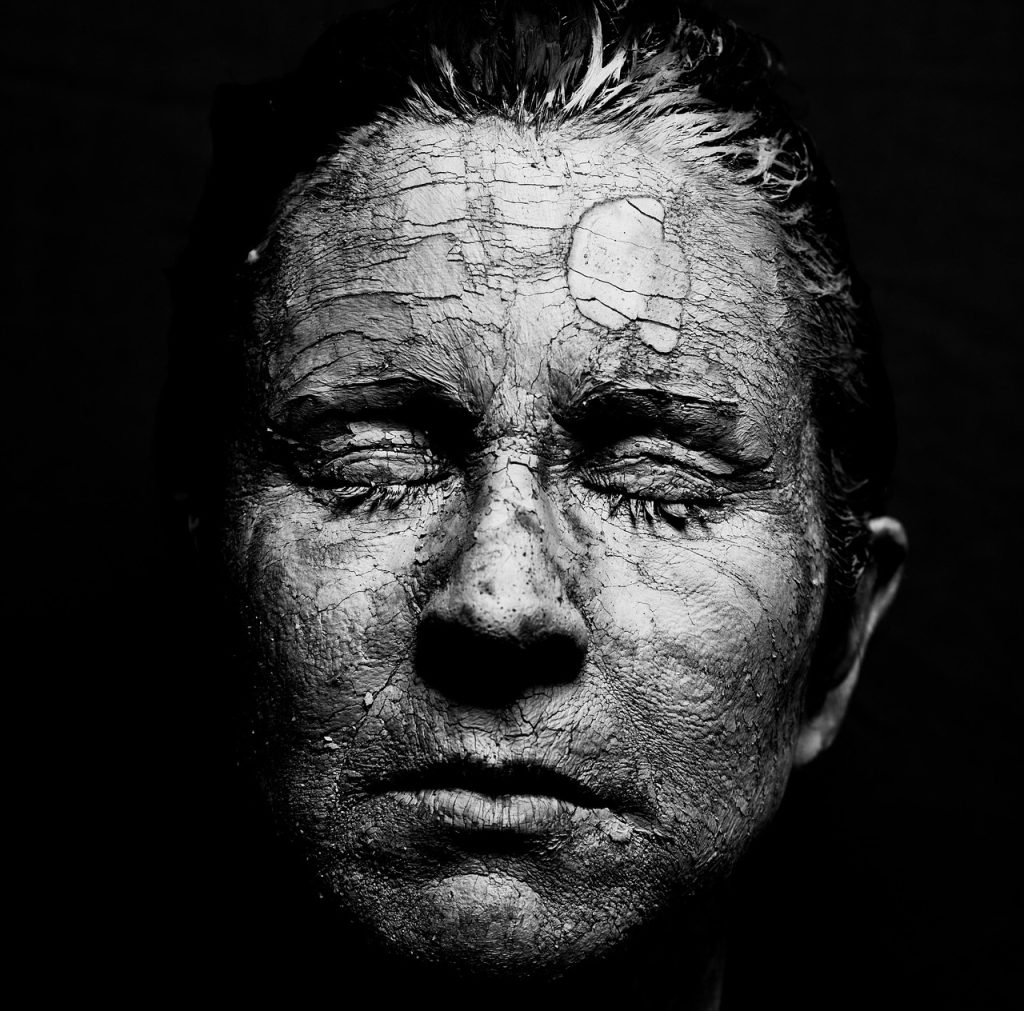 Close-up of a woman’s face with cracked, dry, and textured skin symbolizing skin damage, aging, and the need for skincare or hydration.